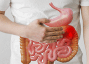 Sakit Perut Jangan Dianggap Sepele, Ini Bahaya Usus Buntu yang Bisa Mengancam Nyawa