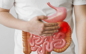 Sakit Perut Jangan Dianggap Sepele, Ini Bahaya Usus Buntu yang Bisa Mengancam Nyawa