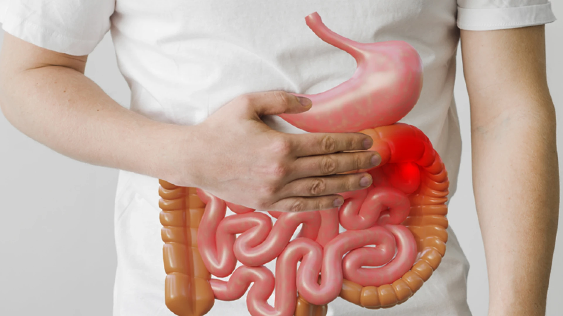 Ilustrasi bahaya usus buntu