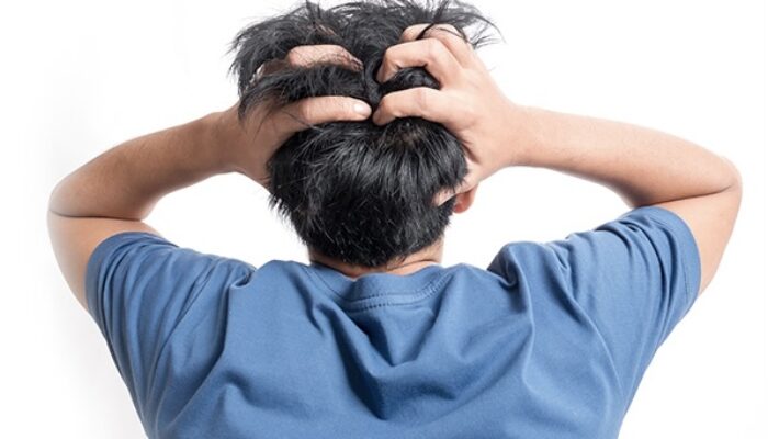 Waspadai Sakit Kepala Berulang, Bisa Jadi Tanda Gangguan Serius pada Otak